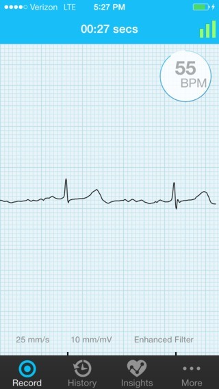 AliveCor