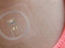 Mayo Clinic, Gentag Partner to Develop Wearable Biosensors for Obesity and Diabetes