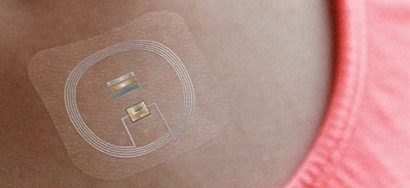 Mayo Clinic, Gentag Partner to Build Develop Wireless Sensors for Obesity and Diabetes