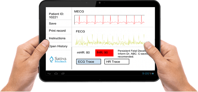 Sattva Medtech_Indian Digital Health Startups to Watch