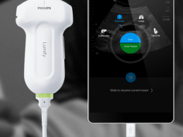 Lumify smart device ultrasound solution Lumify Ultrasound