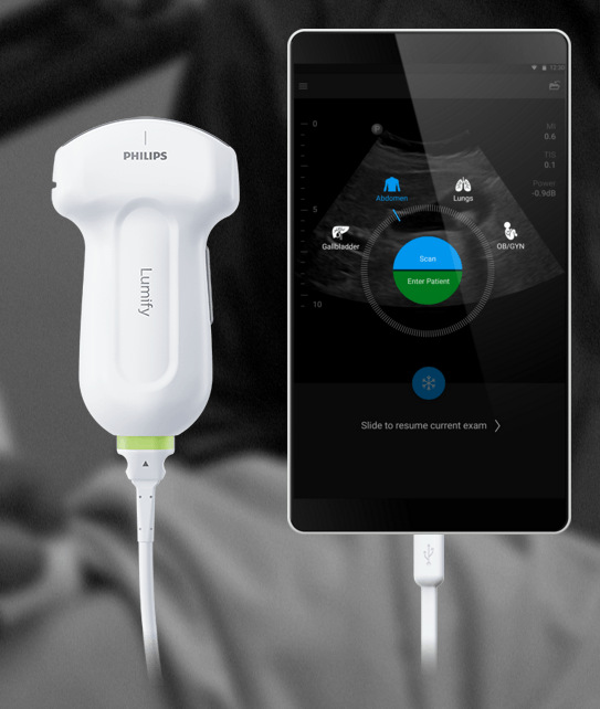 Lumify smart device ultrasound solution Lumify Ultrasound