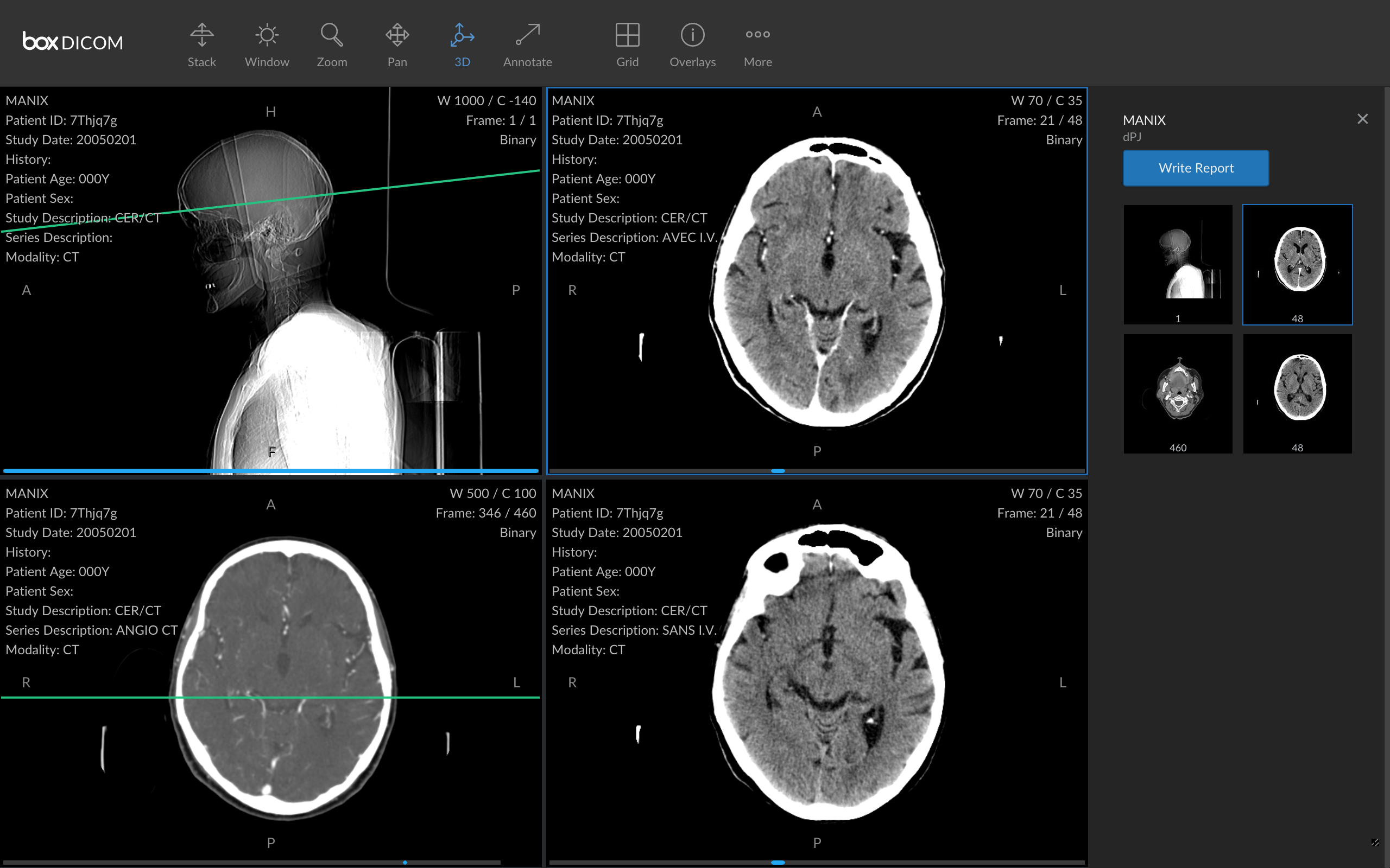 instal the new for mac Sante DICOM Editor 8.2.8