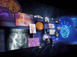 Agfa HealthCare Joins Watson Health Medical Imaging Collaborative