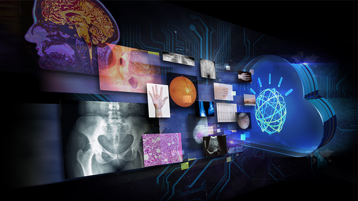 Agfa HealthCare Joins Watson Health Medical Imaging Collaborative