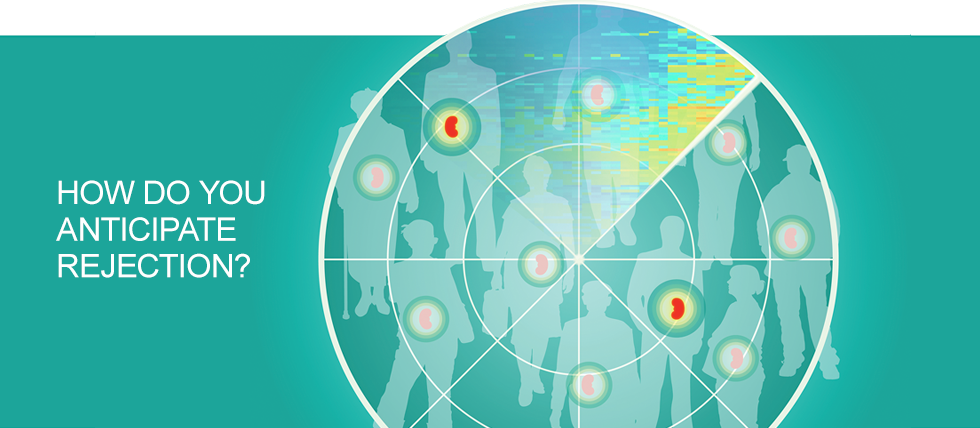 Transplant Genomics