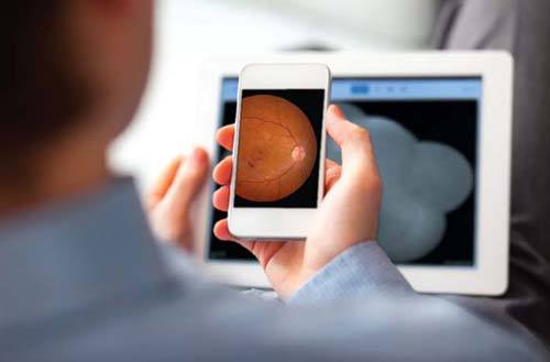 Diabetic Retinopathy Telemedicine Improves HEDIS Quality Measures