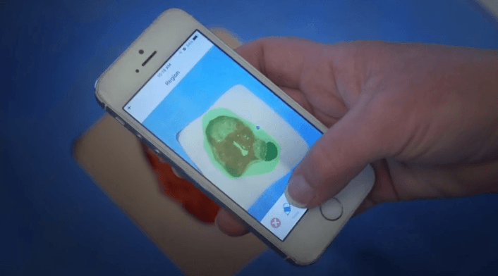 PointClickCare Launches EHR Integrated Skin & Wound App