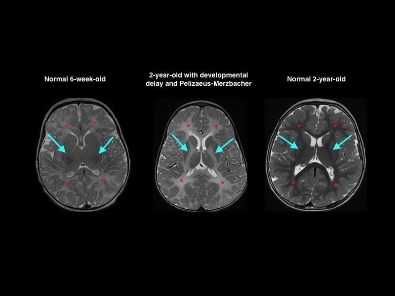 ge-bostonchildrens-brains-venture