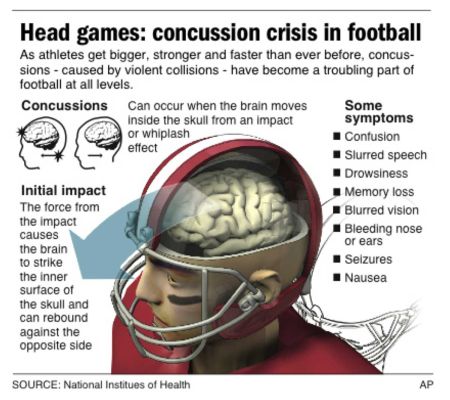 GE, Houston Texans to Fund 2-Year Concussion Telemedicine Pilot