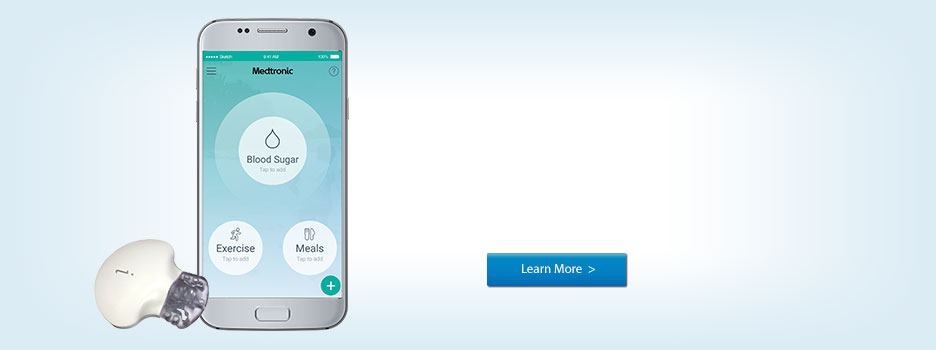 Medtronic Integrates with Fitbit to Understand How Exercise Impacts Glucose Levels
