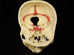 mount-sinai-establishes-3d-printing-services-for-clinicians-and-researchers