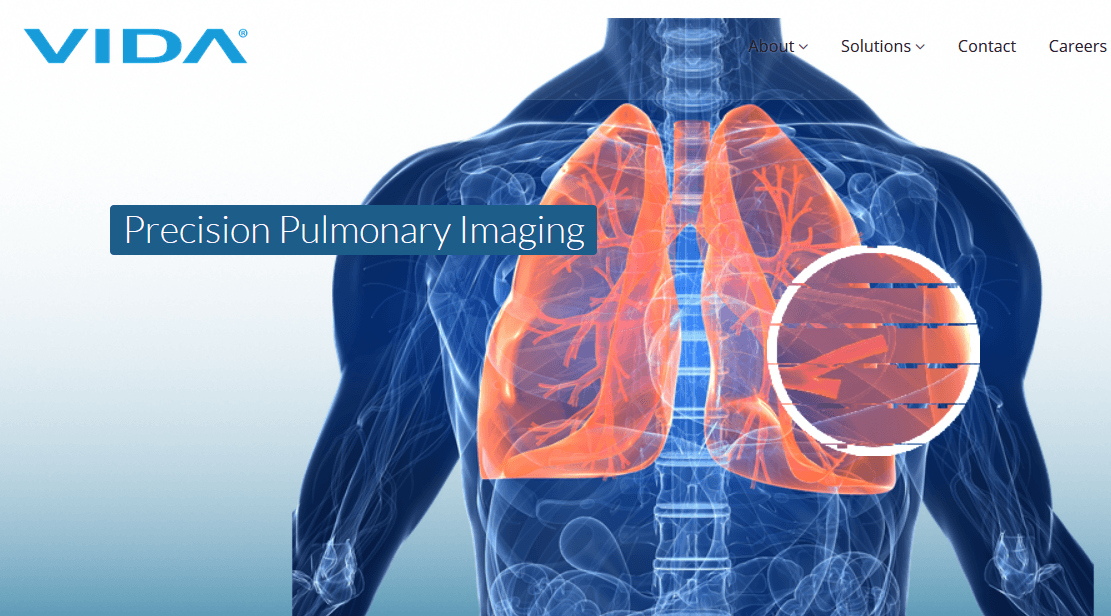 VIDA Raises $5.1m in Round B Funding to Commercialize Precision Pulmonary Informatics Software and Services