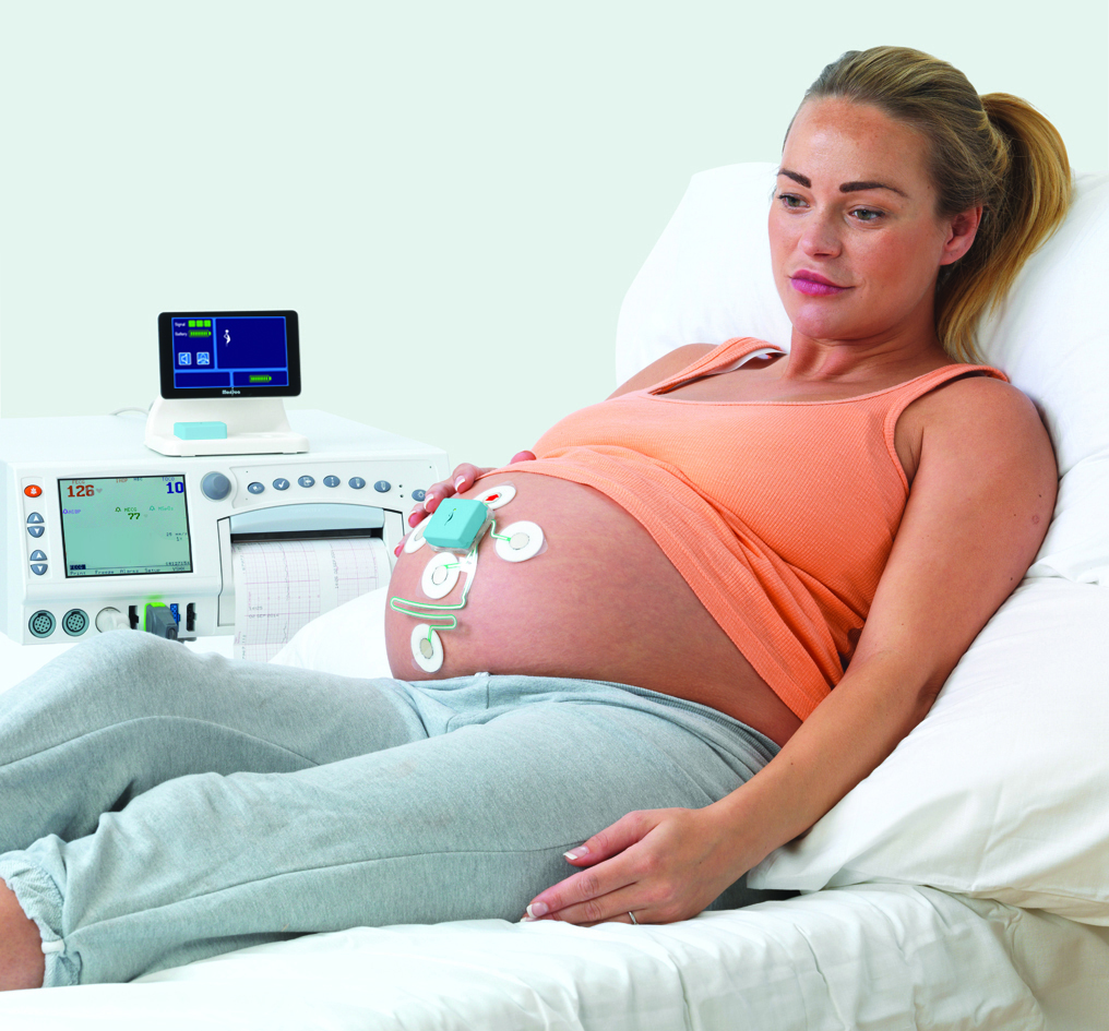 GE Healthcare Acquires Fetal Monitoring Technology Monica Healthcare