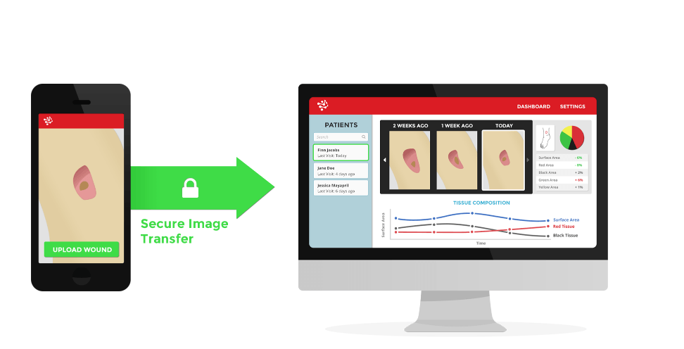 Intermountain Healthcare to Implement Wound Tracking App Integrated with Cerner EHR Across Enterprise