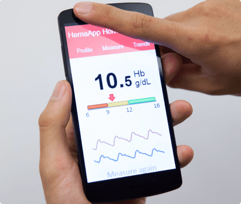 Google Acquires Mobile Health Monitoring Startup Senosis Health