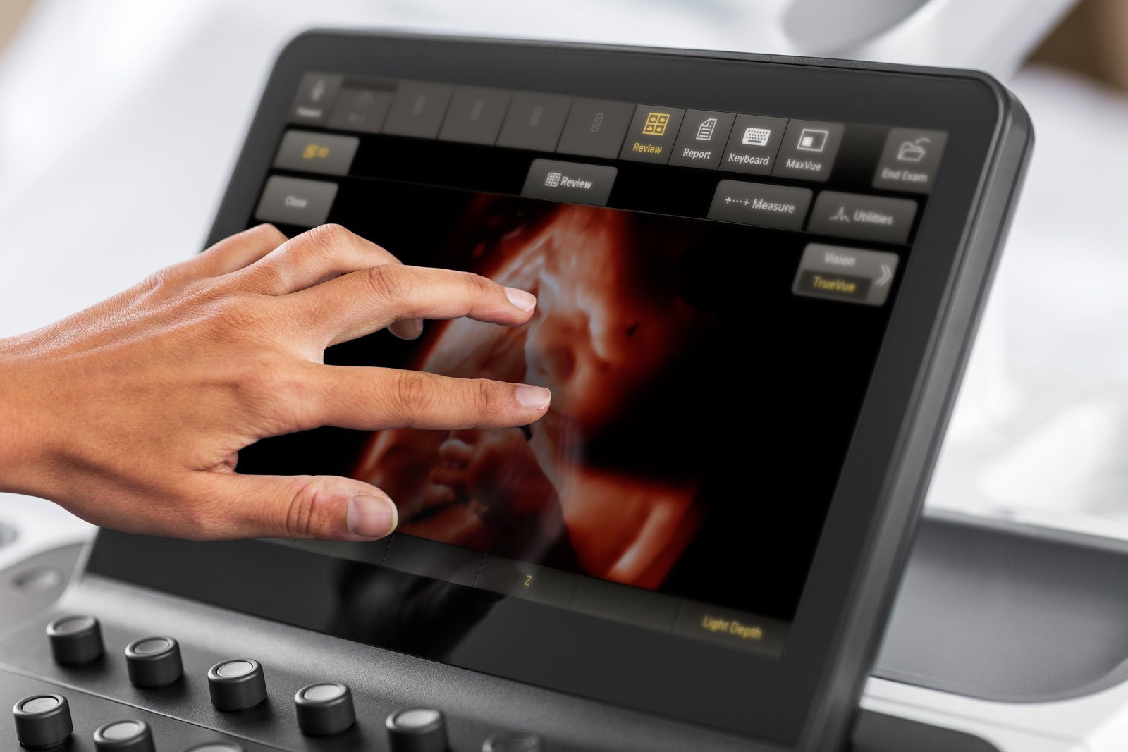 Philips Unveils New OB/GYN Ultrasound Innovations Featuring Anatomical Intelligence