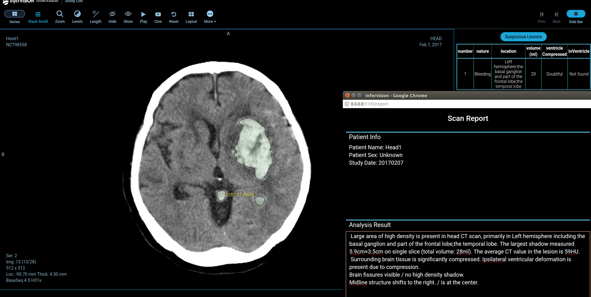 MedTech Startup Launches AI Platform