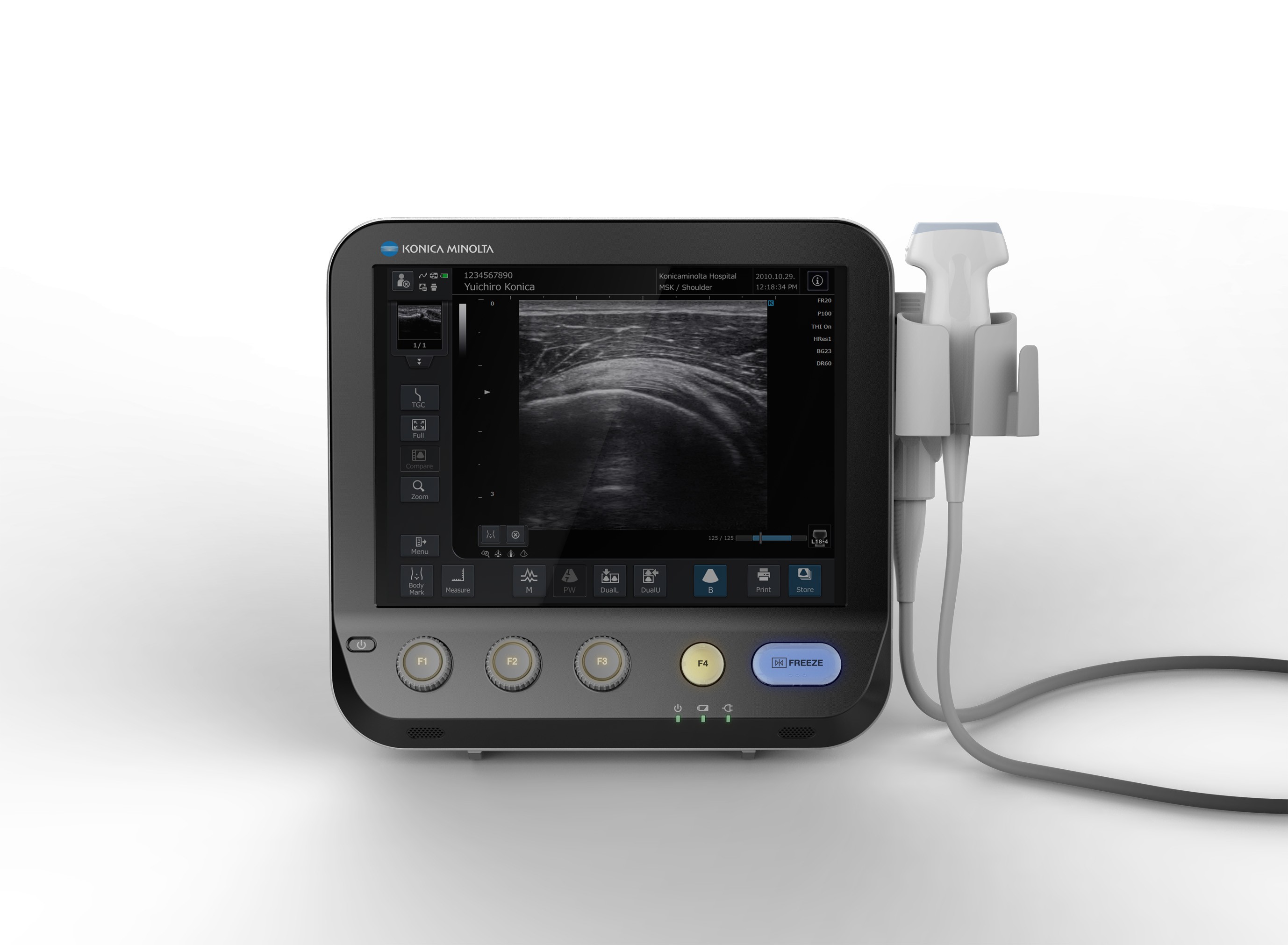 Konica Minolta Launches Portable Ultrasound for Optimized Clinical Workflow