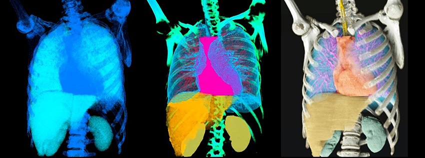 NVIDIA, American College of Radiology Partner to Accelerate AI for Diagnostic Radiology