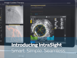 Philips Launches New IntraSight Interventional Applications Platform for Image-Guided Therapies