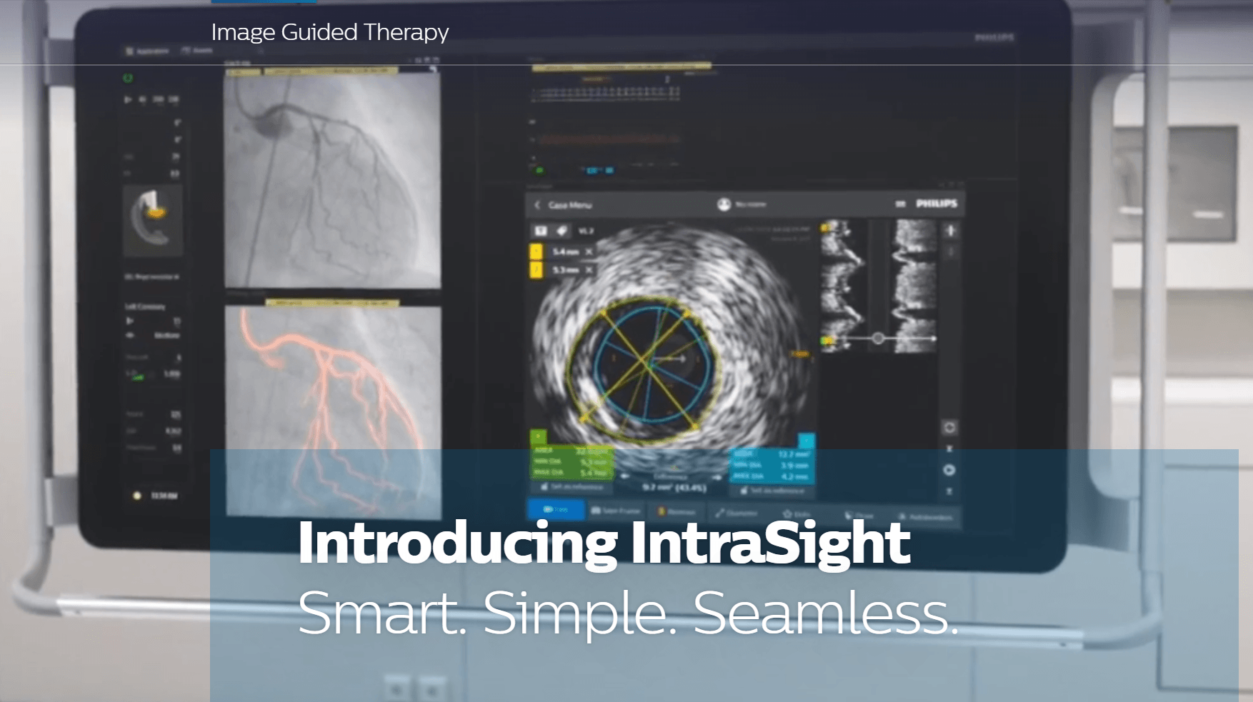 Philips Launches New IntraSight Interventional Applications Platform for Image-Guided Therapies