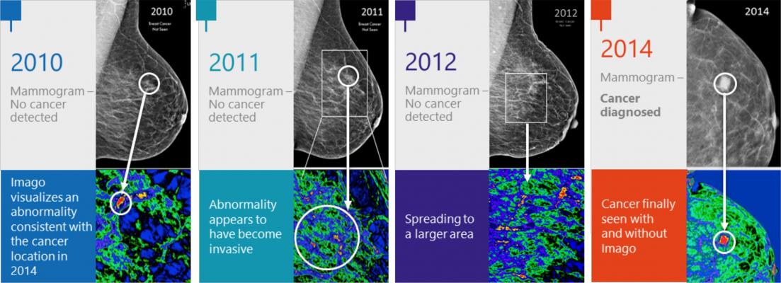 Mayo Clinic Backs Imago Systems to “Re-Visualize” The Mammogram for Breast  Cancer Detection 