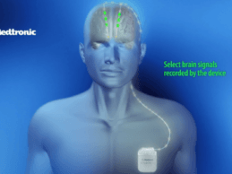 Medtronic Launches FDA-Approved Deep Brain Stimulation Device in U.S.