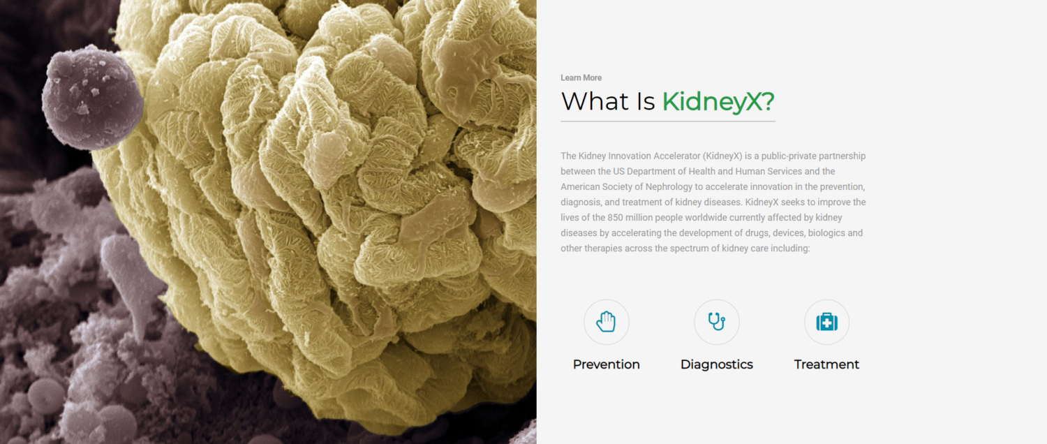 HHS Launches 1.5M Second Phase of KidneyX Prize Competition to