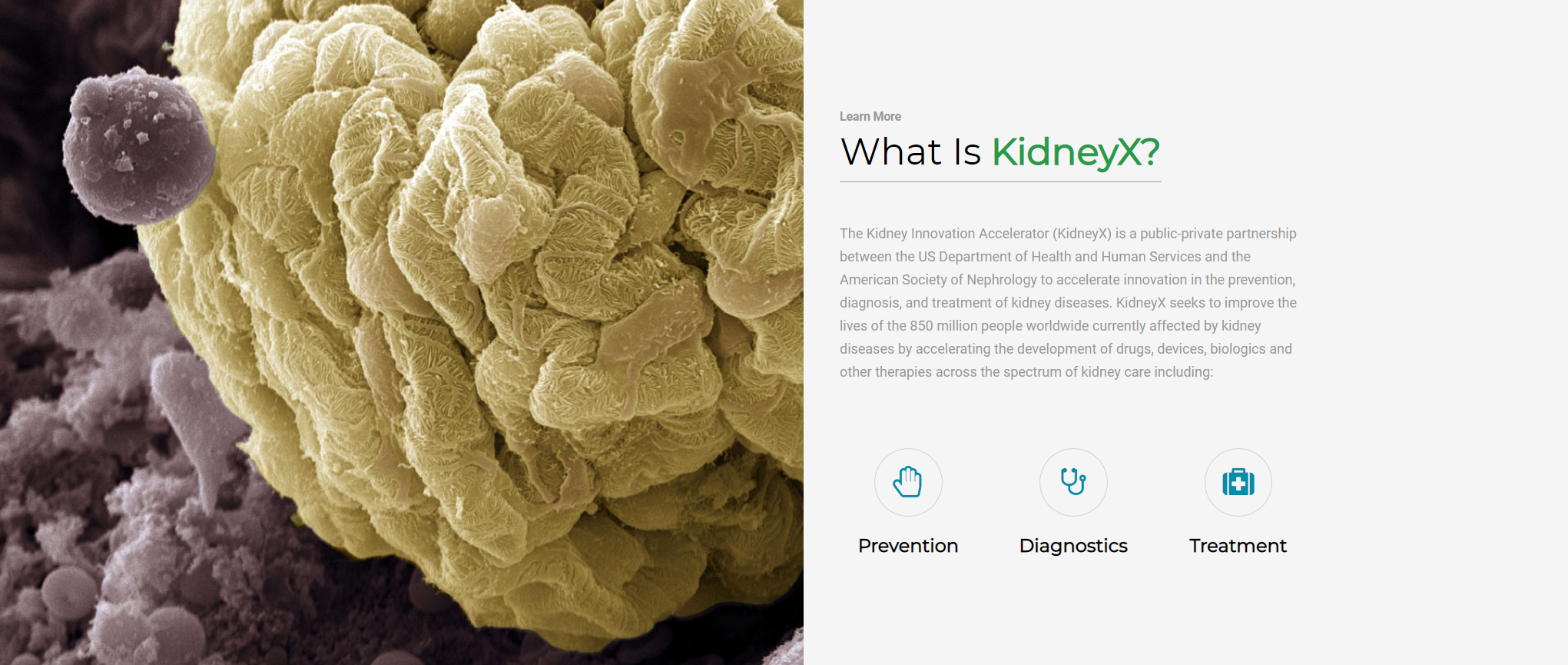 HHS Launches $1.5M Second Phase of KidneyX Prize Competition to Redesign Dialysis