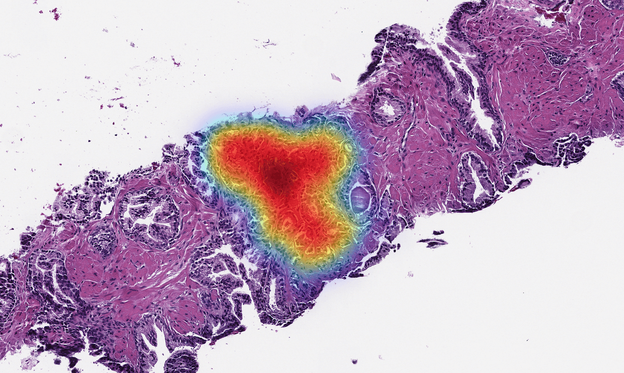 Paige Raises $45M to Expand AI-Native Digital Pathology Ecosystem