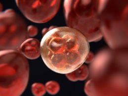 Notable Launches Observational Clinical Trial for Patients with Blood Cancer