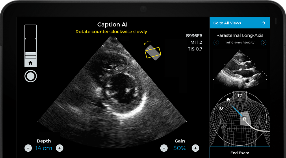 Caption Health AI Awarded FDA Clearance for Point-of-Care Ejection Fraction Evaluation 