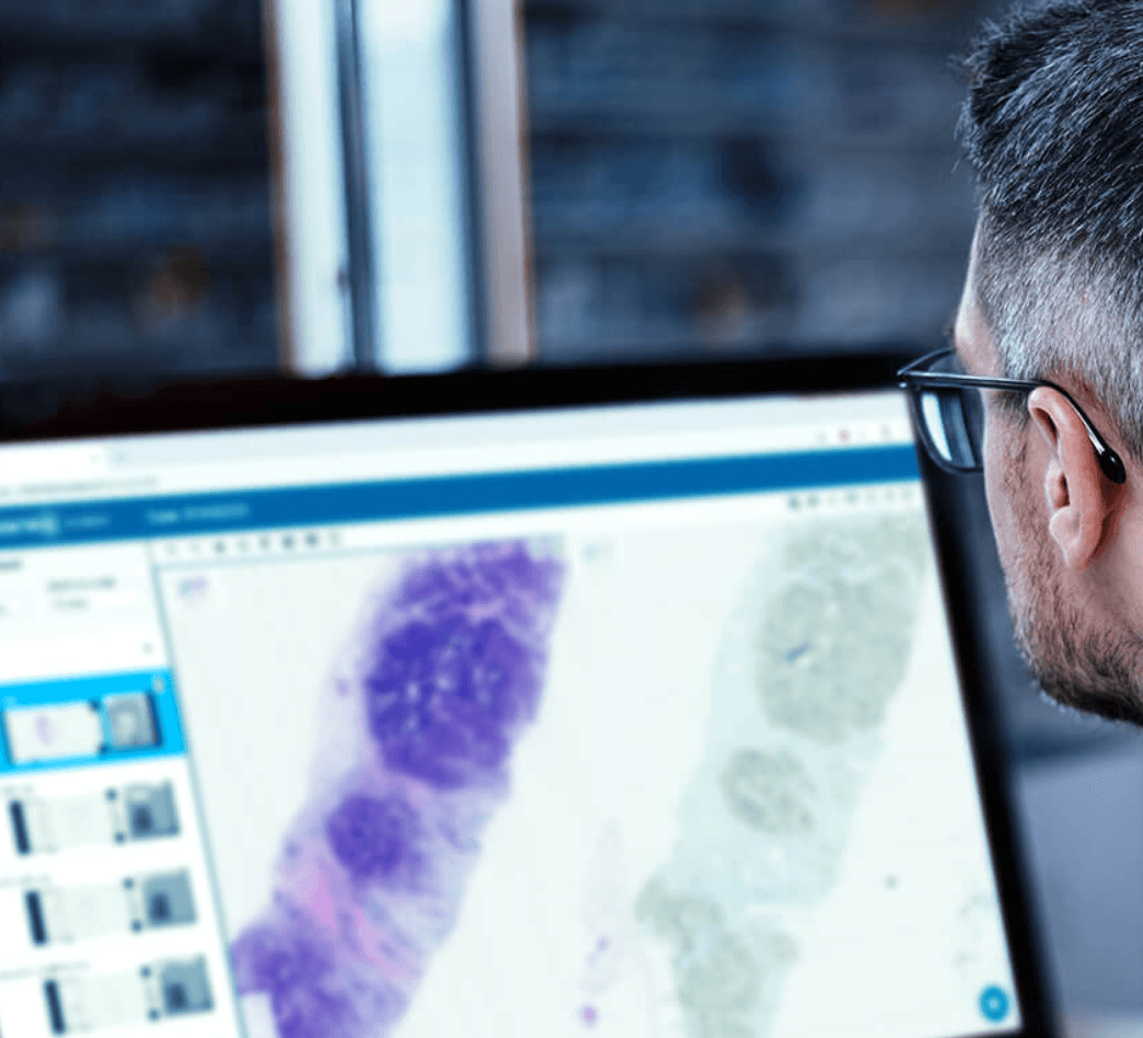 Philips Partners With Proscia to Accelerate Digital Pathology Adoption