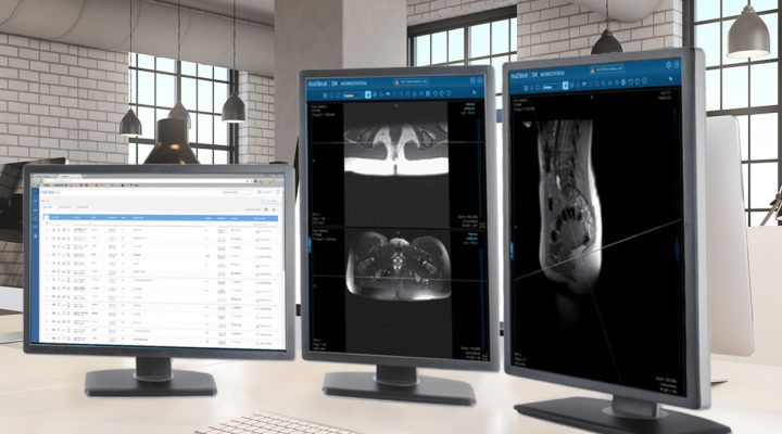 Change Healthcare Acquires Cloud-Native Imaging Platform Nucleus.io