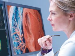 Philips Unveils Vendor-Neutral Radiology Operations Command Center, Automated Radiology Workflow Suite