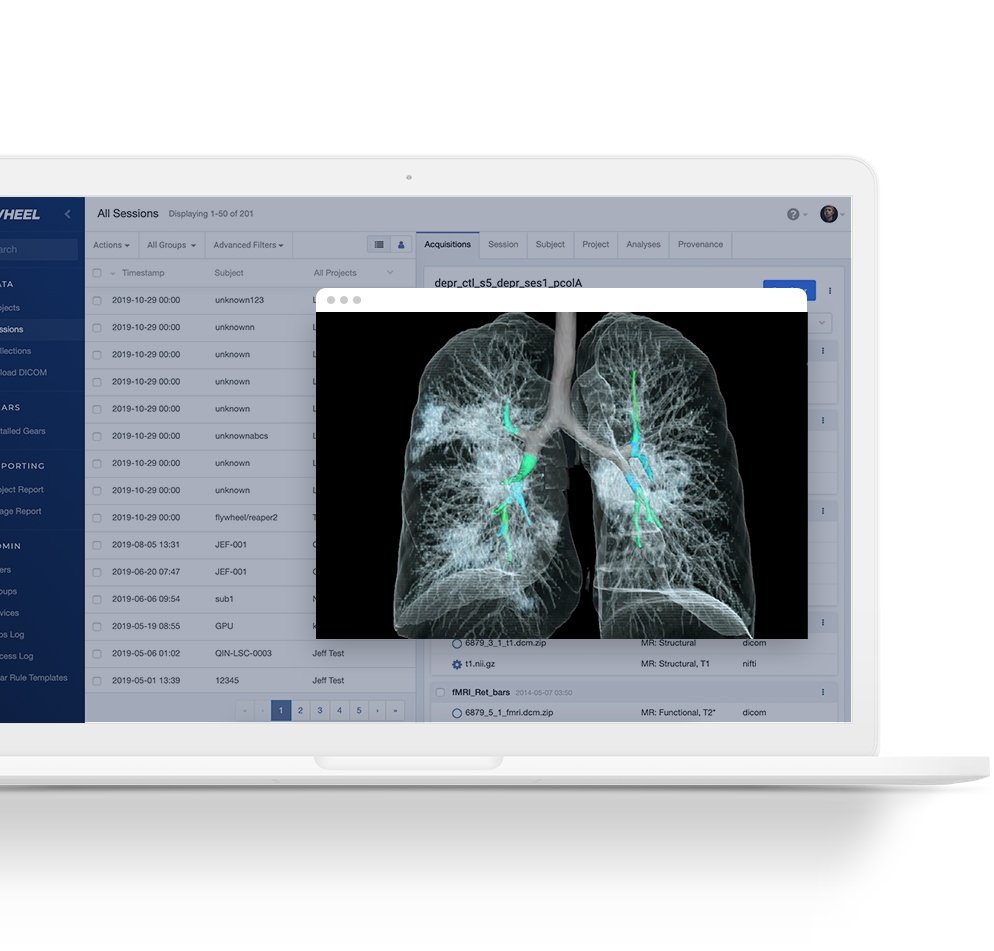 Flywheel Nabs $15M for Next-Gen Informatics Platform for Medical Research & Collaboration