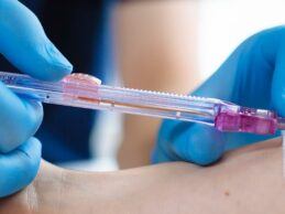 Holy Name to Offer Needle-Free Blood Draws for Inpatients, First Hospital in NJ