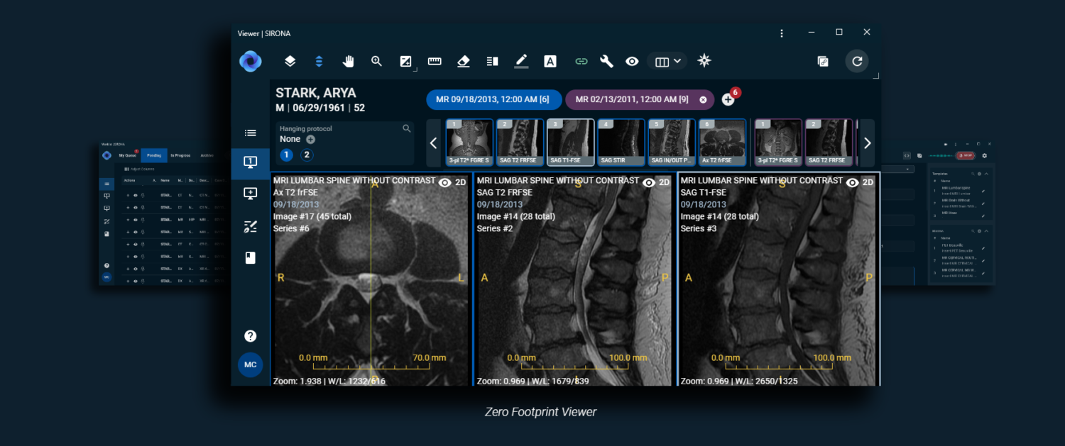 Rad AI Startup Sirona Medical Emerges from Stealth with $22.5M, Partnerships