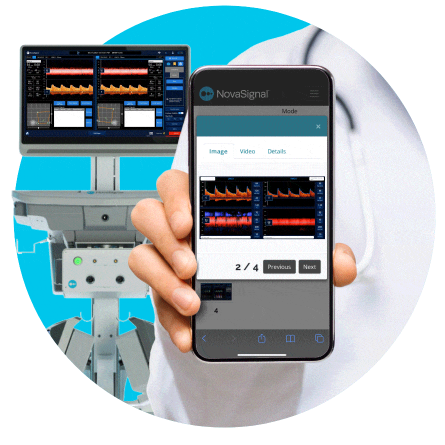 NovaSignal Secures $37M for Capture Blood Flow Data in Real-Time