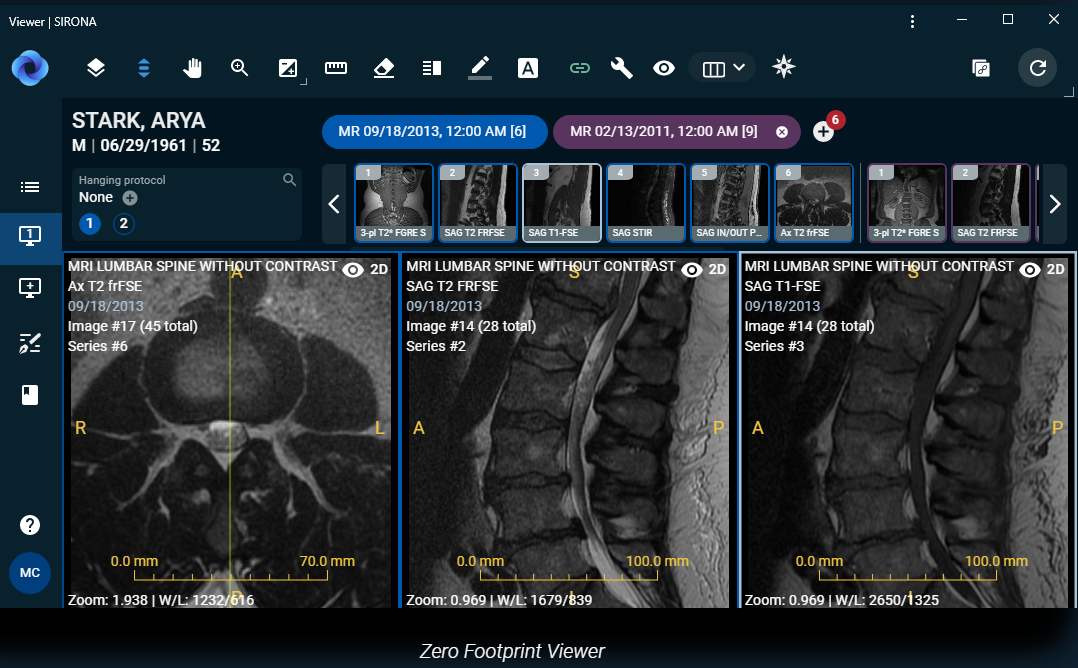 Sirona Medical Secures $40M for Cloud-Native Radiology Operating System