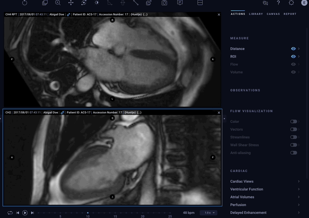 Arterys Receives FDA Clearance for Next-Gen Cardiac MRI App