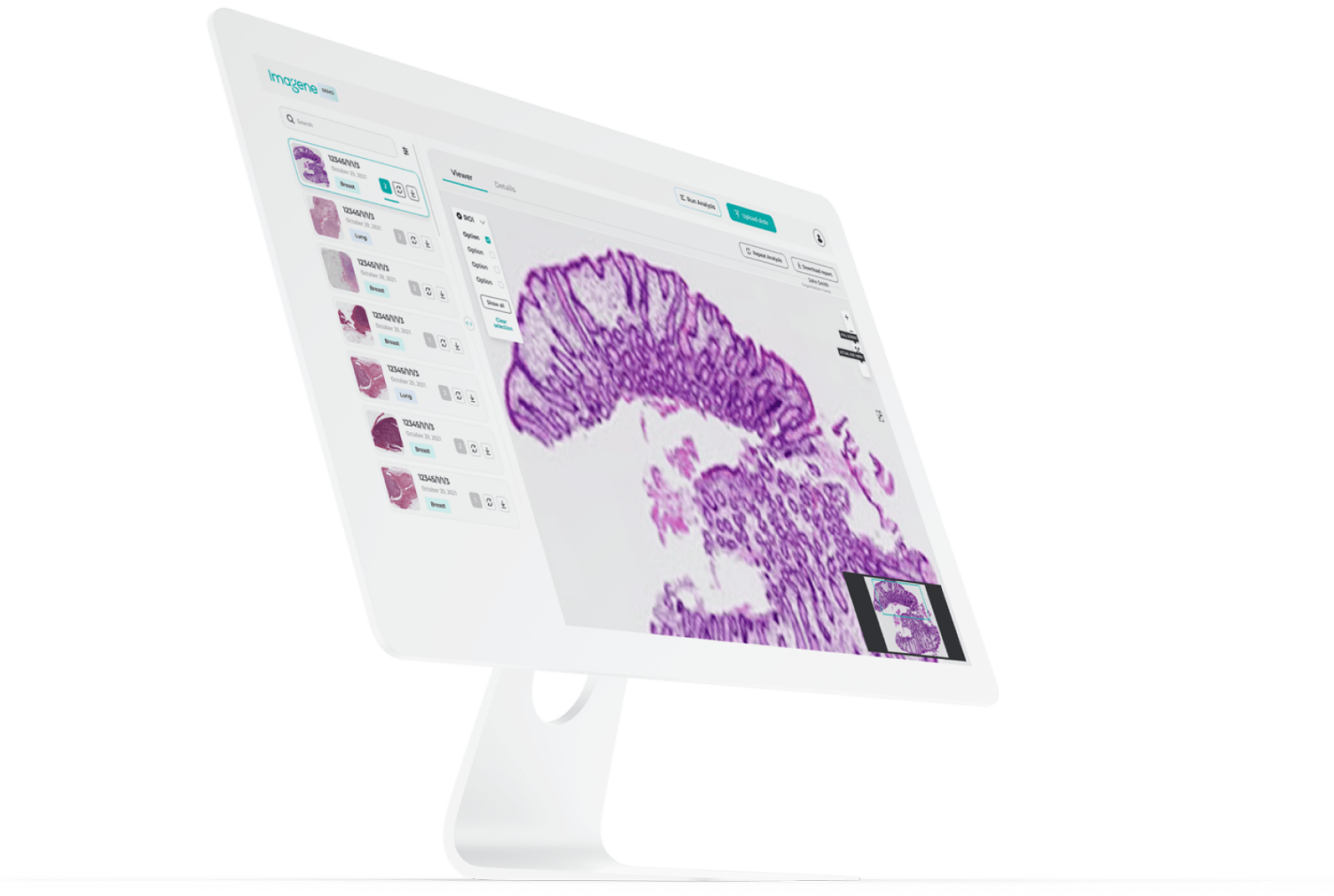 Imagene Raises $21.5M to Expand Image-Based Biomarker Detection for Precision Medicine