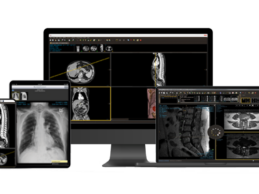 Intelerad & DiA Imaging Analysis Partner to Empower Echocardiography Labs with AI