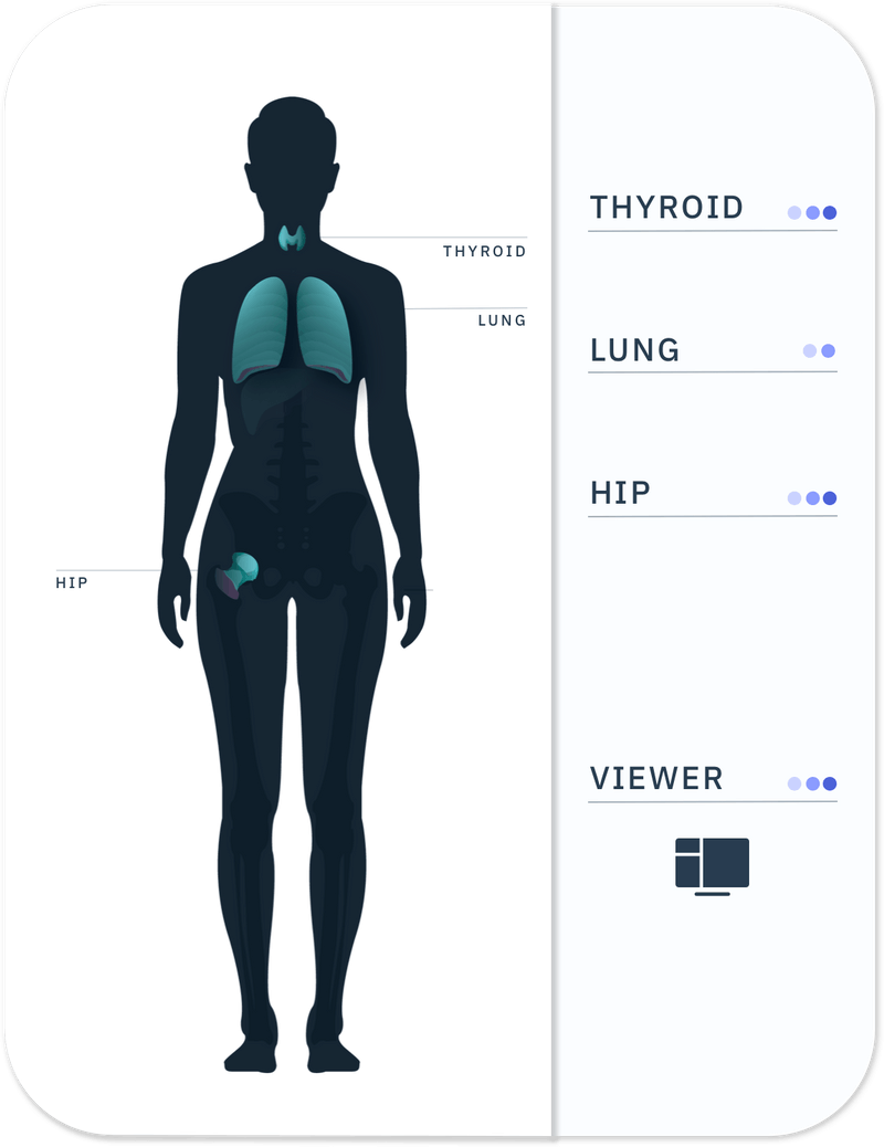 Exo Acquires Medo to Make Ultrasounds Simple and Accessible