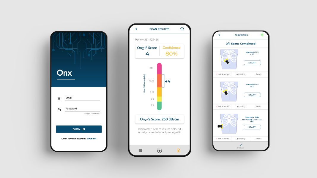 Oncoustics Raises $5M for AI-Driven Point-of-Care Diagnostics