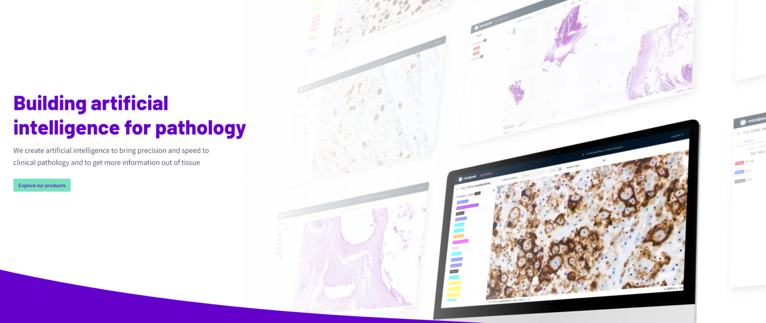 Tribun Health, Mindpeak Partner on AI Diagnostic Tool for Breast Cancer for Pathologists