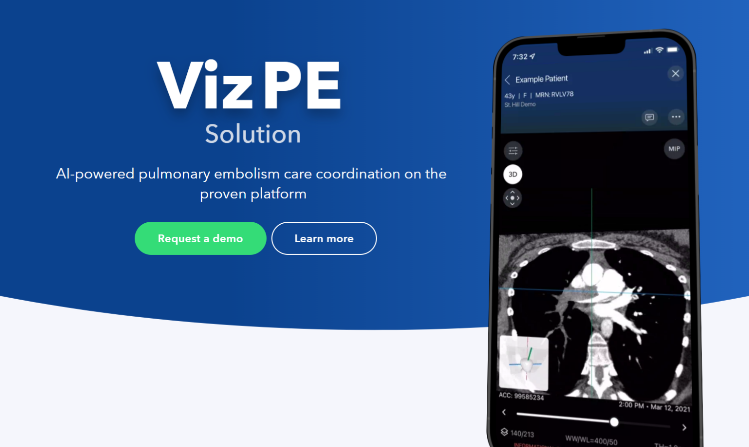 Viz.ai Receives Clearance for New Algorithm for Pulmonary Embolism