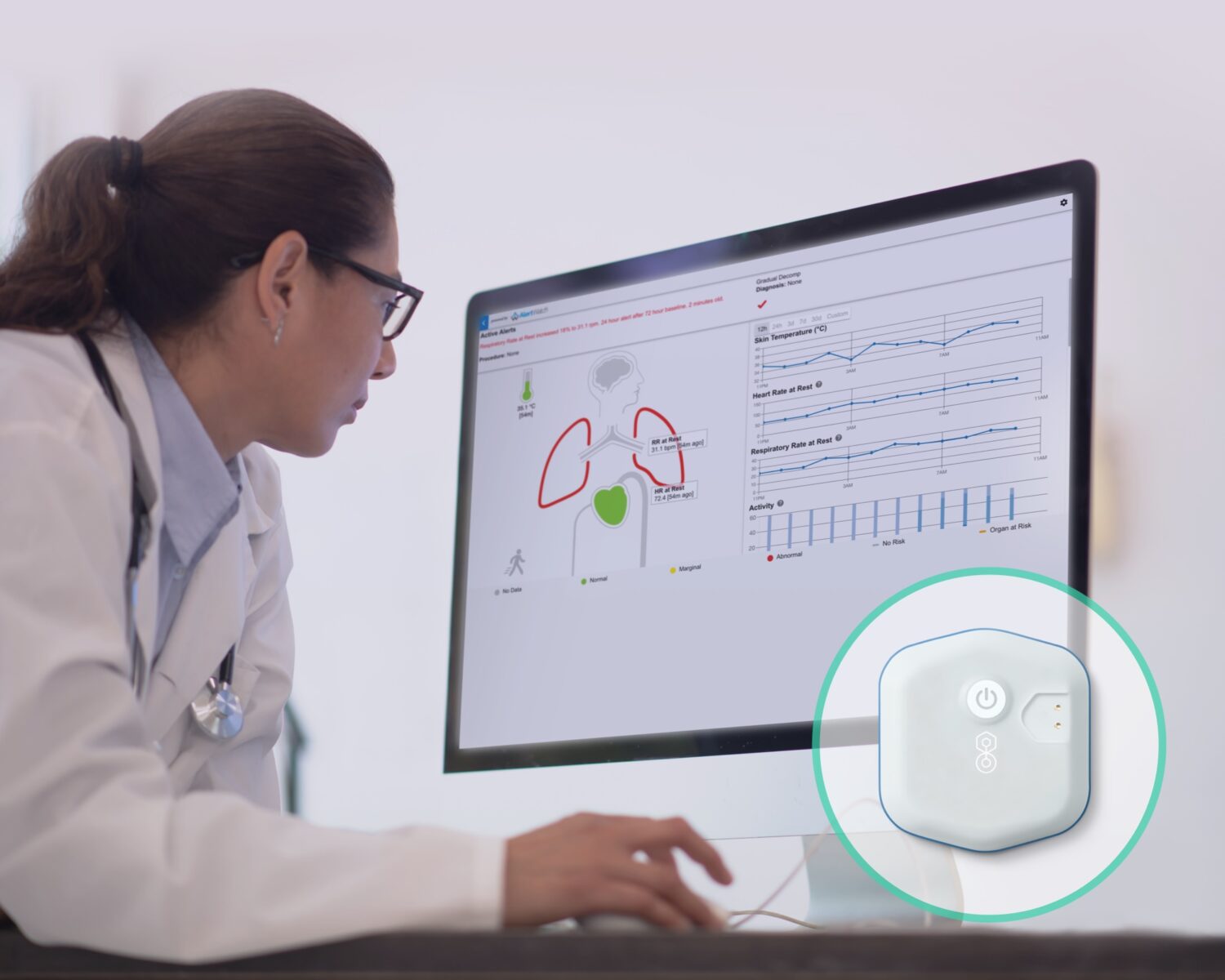 BioIntelliSense Acquires AlertWatch to Expand Continuous Patient Monitoring Solutions