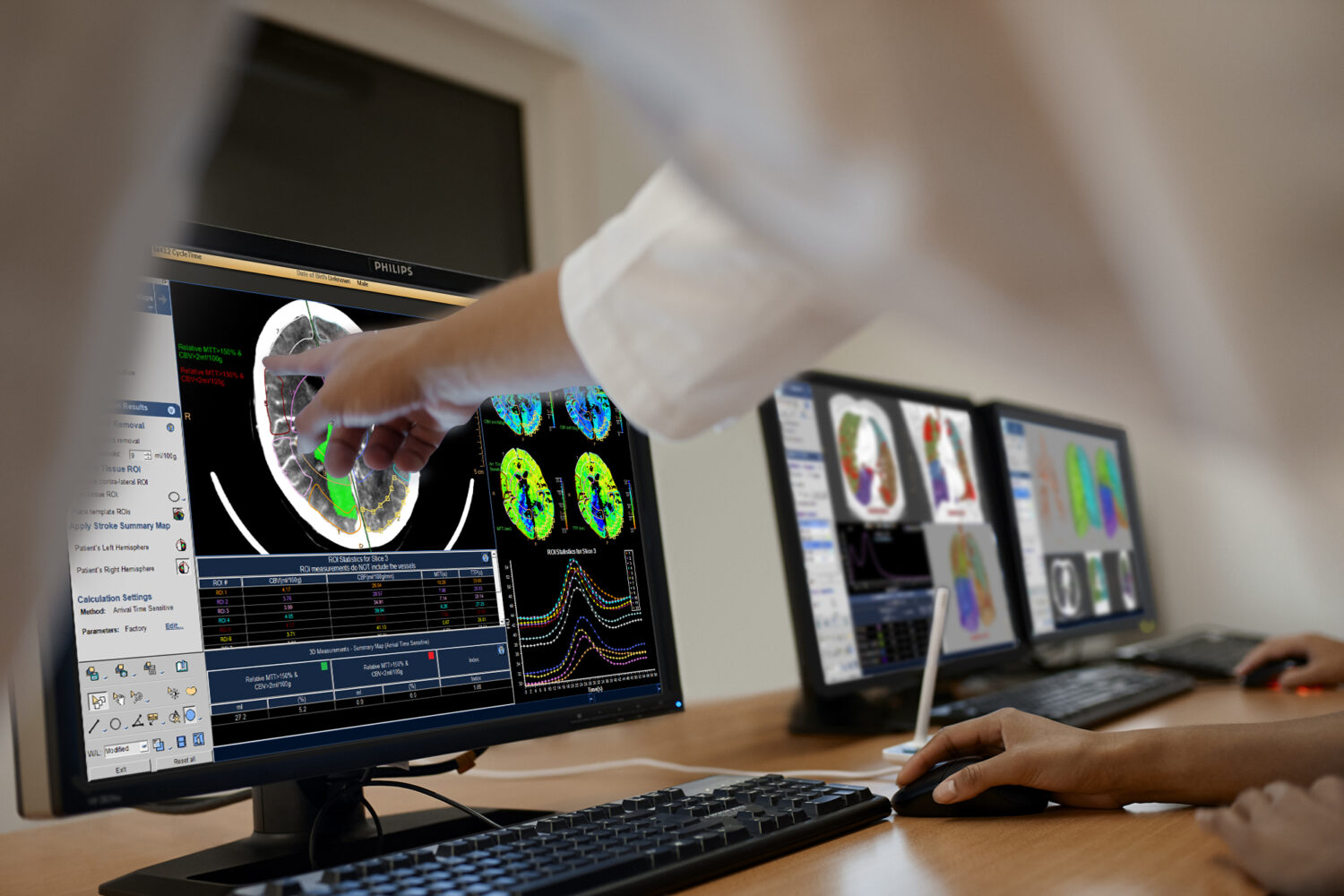 RNSA22: Philips Unveils AI-Enhanced Informatics Solutions to Optimize Radiology Workflow